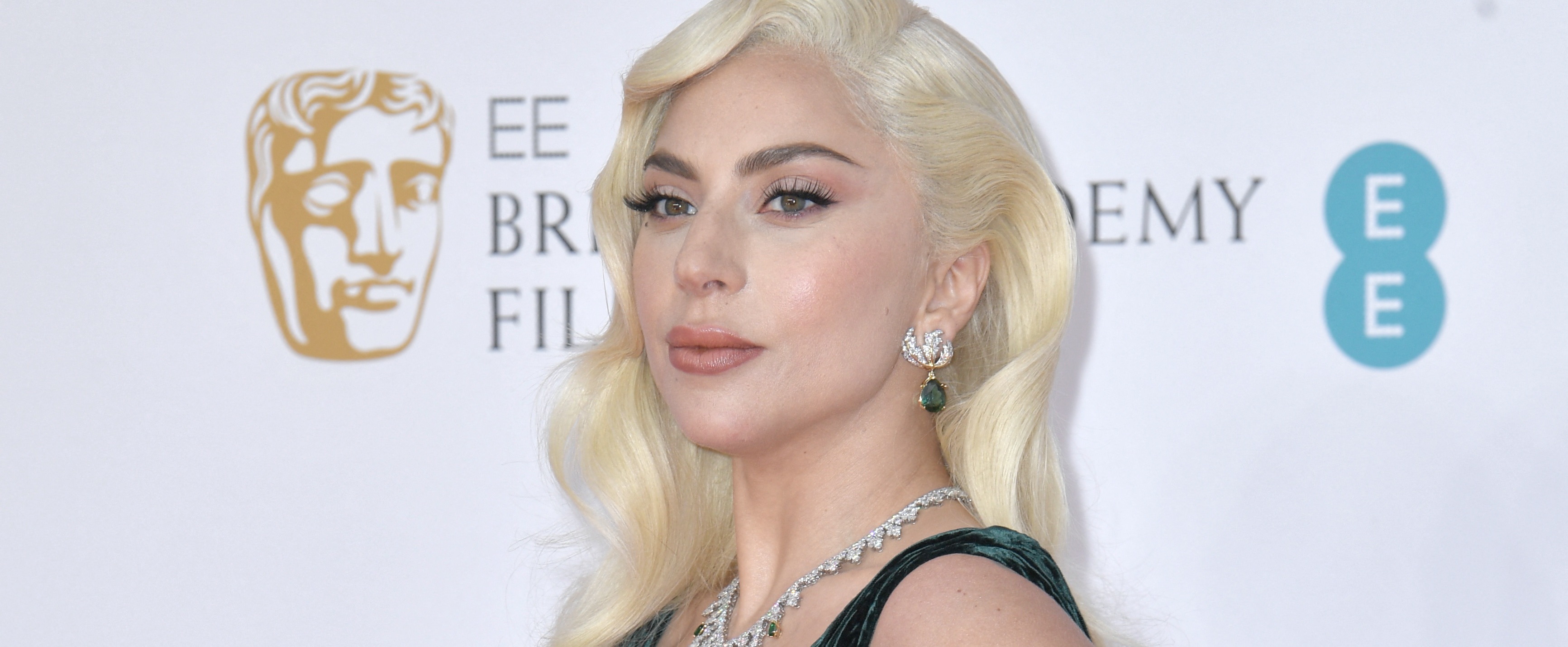 Je zou maar aangeklaagd worden door je eigen hondendief: Lady Gaga overkomt het