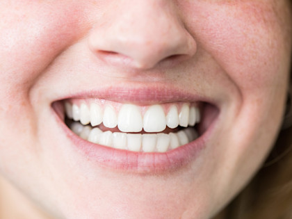 FS24-teeth