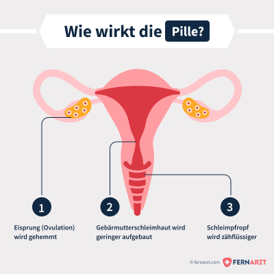 30 unterschied und swingo 30 mite swingo Erfahrungen mit