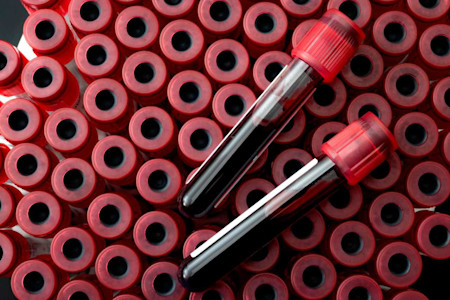 Blutröhrchen mit Blutproben. Hämoglobin macht das Blut rot.