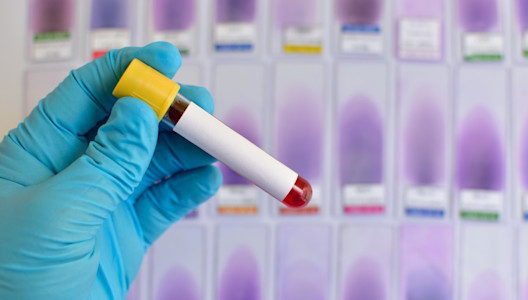 Eine Hand mit einem blauen Handschuh hält eine Blutprobe im Röhrchen.