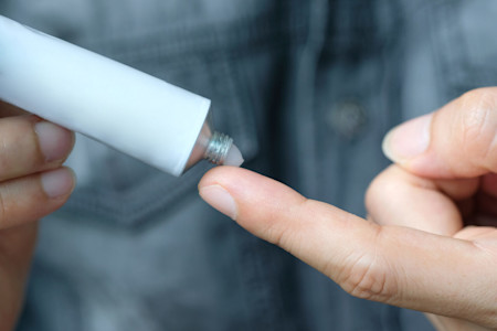 Ein Mann drückt Salbe aus einer Tube auf seine Fingerspitze.