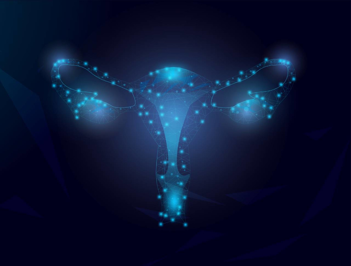 Grafische Darstellung von Gebärmutter (Uterus) und Eileiter (Ovarien).