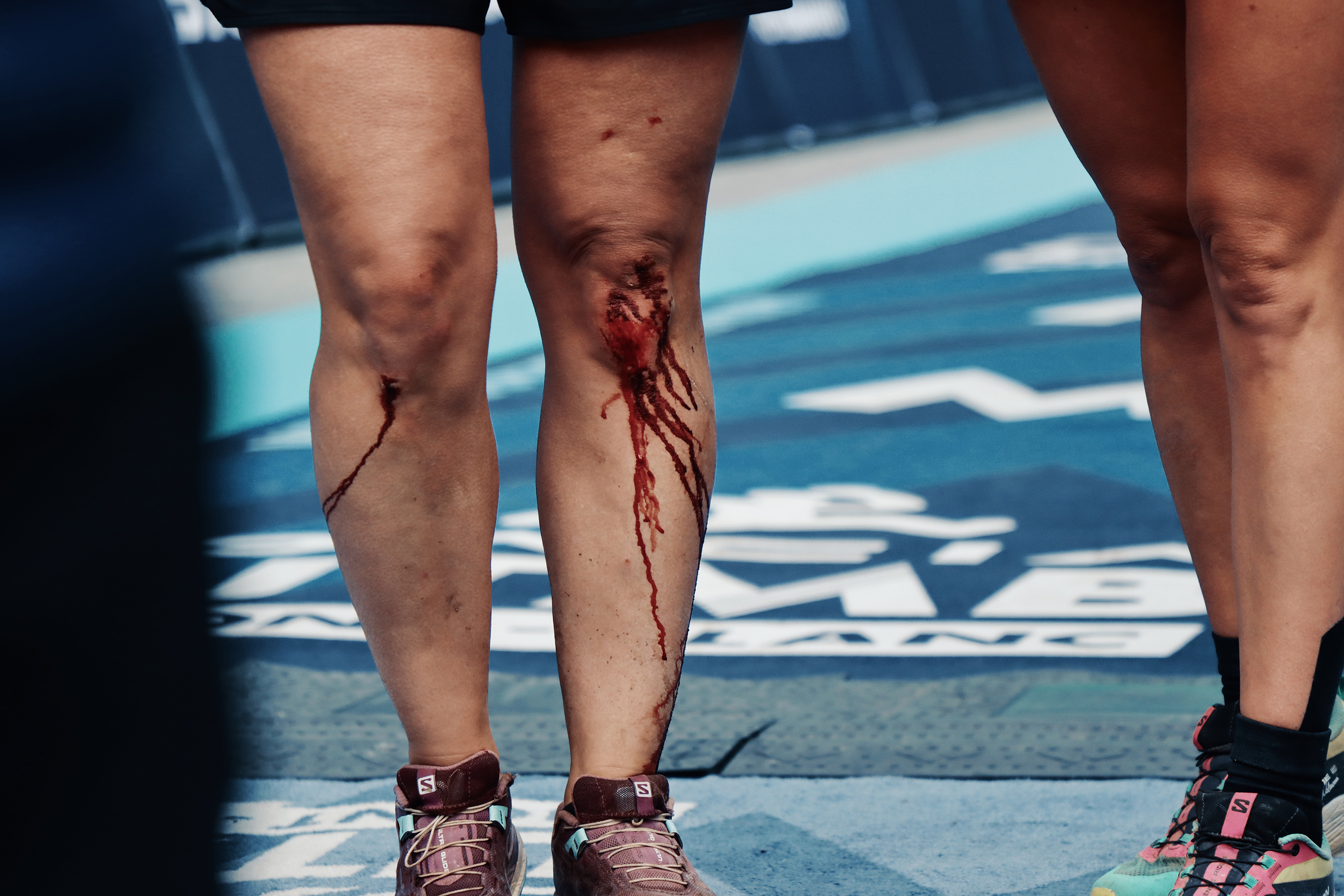 Blood, sweat and tears isn’t just a chiché during UTMB. Photograph: Richard Miller
