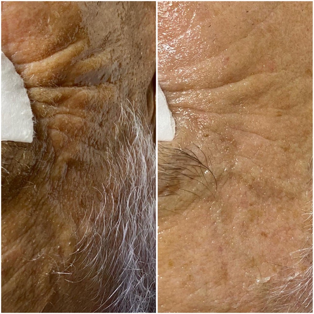 Exuviance anti-age kasvohoito, Kauneuden ilo - Jyväskylä