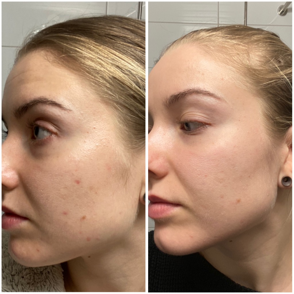 Exuviance A-vitamiinikuorinta, Kauneuden ilo - Jyväskylä