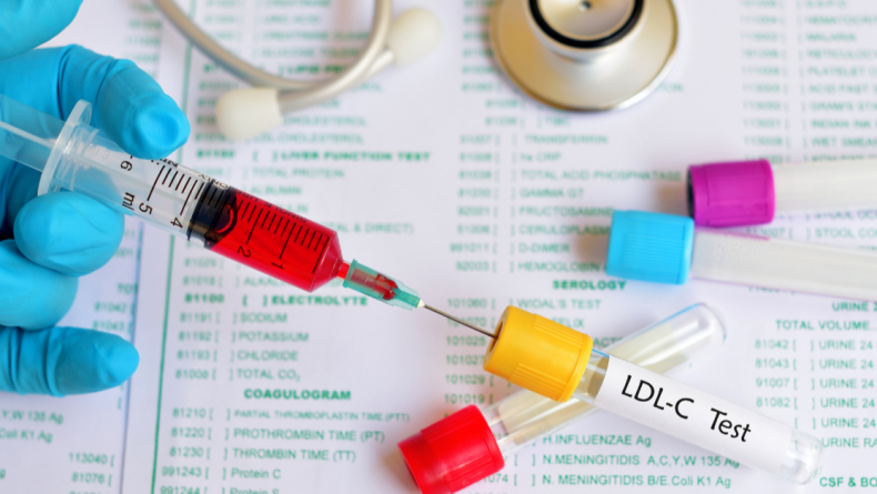 LDL cholesterol blood work test