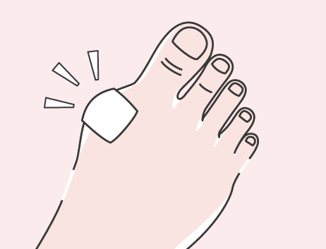 外反母趾 最大の要因は靴