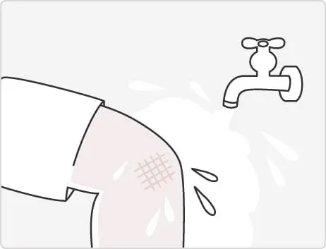 キズパワーパッド™の使い方STEP1 キズ口を洗う