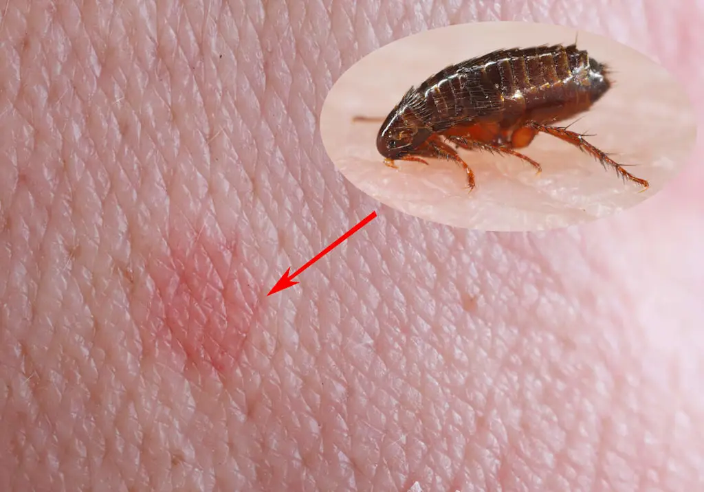 flea-bite-on-skin-with-inset-closeup