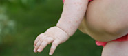 Baby Heat Rash Symptoms Prevention And Treatment Pampers