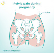 Symphysis Pubis Dysfunction SPD Symptoms And Treatment Pampers