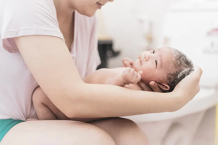 baby born without a face