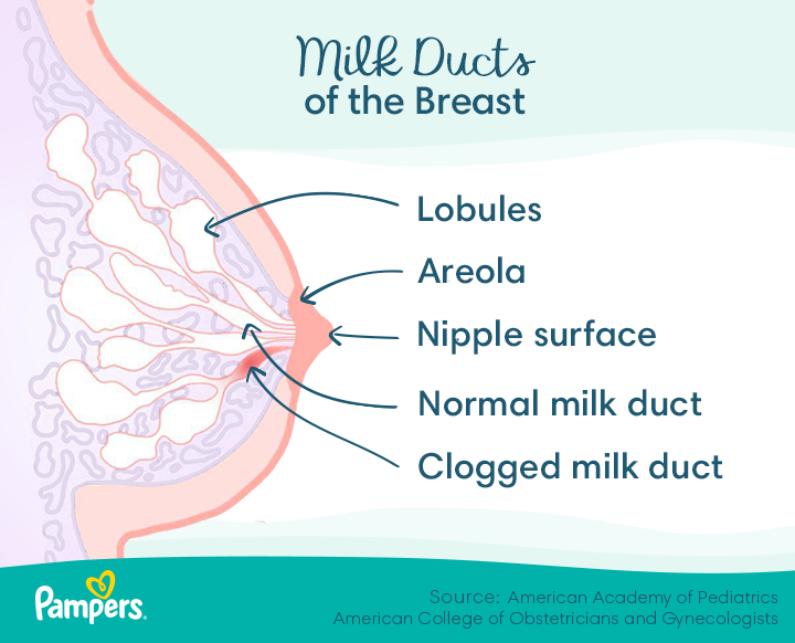 Clogged Milk Duct: Symptoms and Treatment