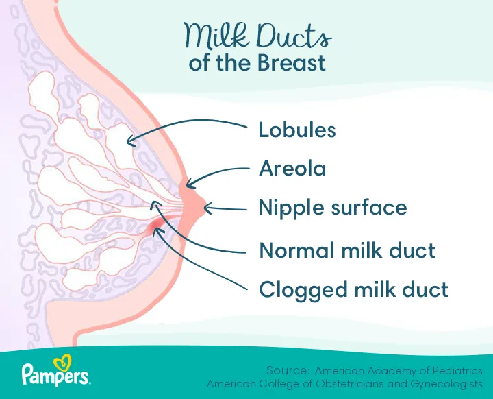 Common Treatments for Breast Engorgement, Blocked Milk Ducts & Mastitis