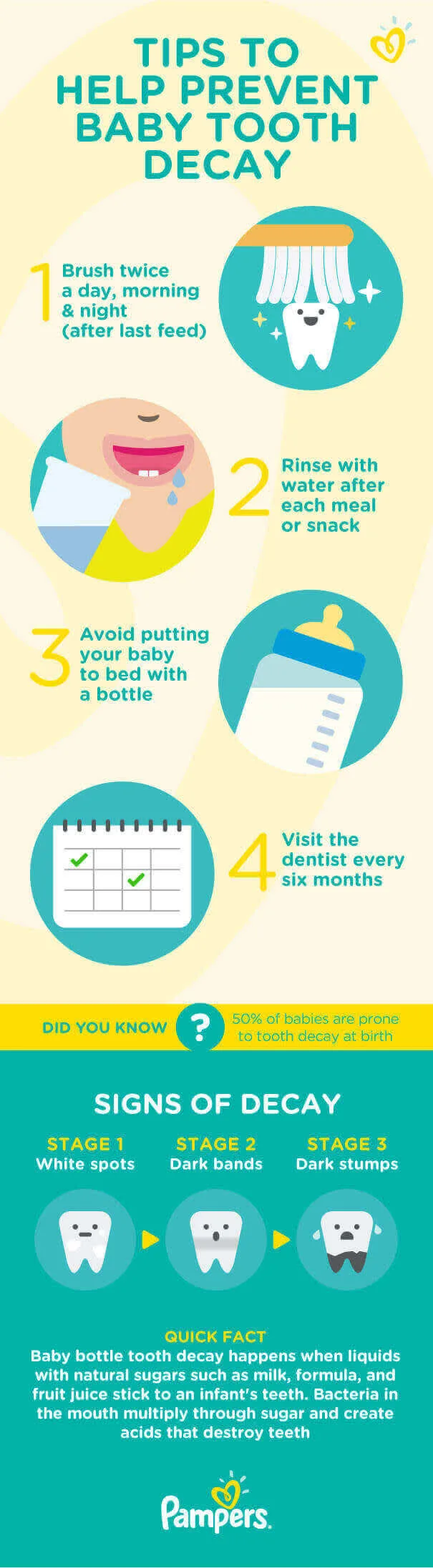 Tips to help prevent baby tooth decay