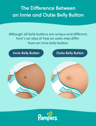 What to Know About Outie Belly Buttons in Babies