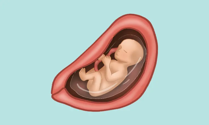 24 weeks fetus in womb