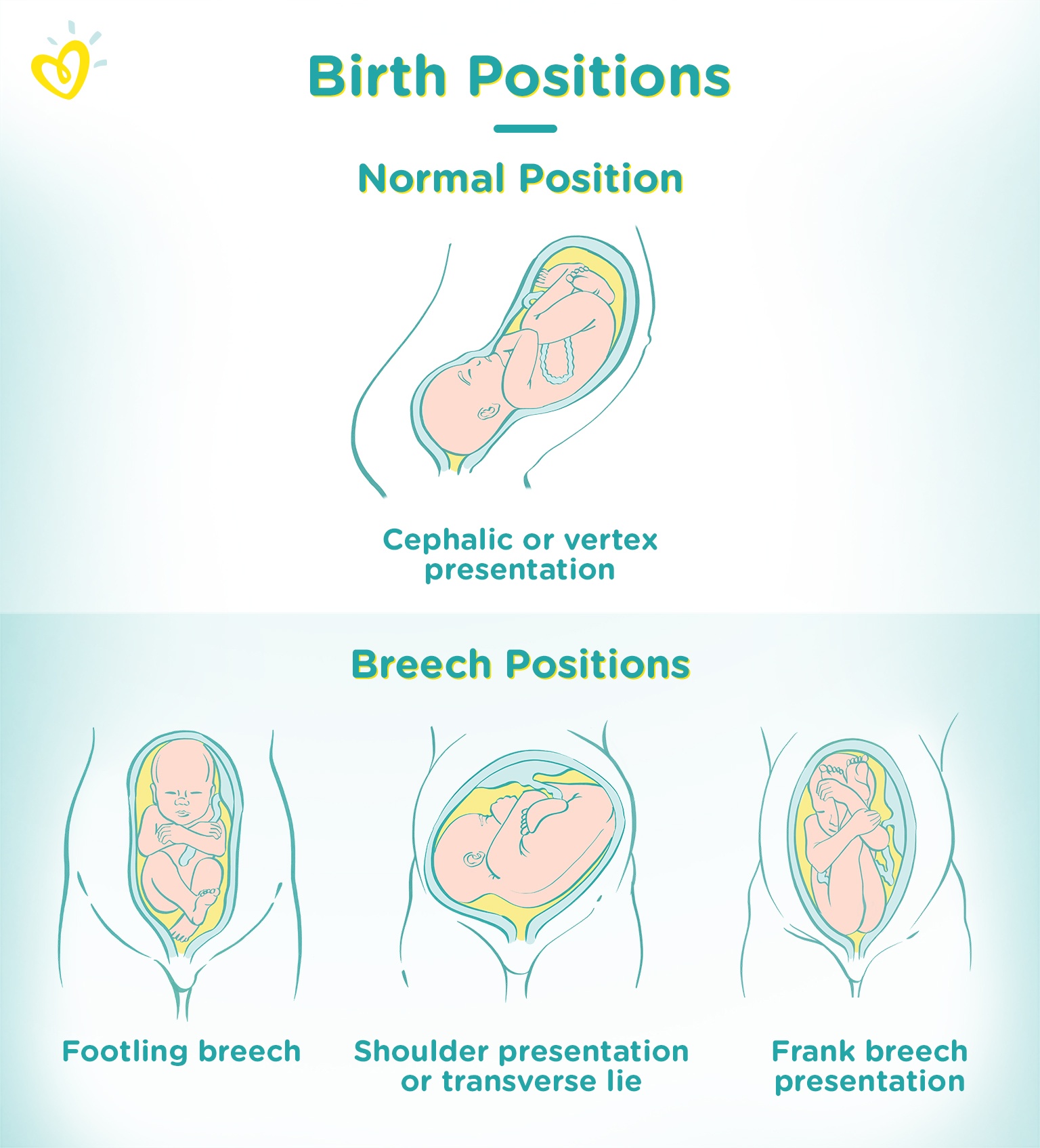 position and presentation of baby