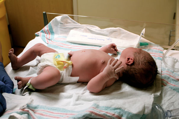 Changing Newborn Diapers: Umbilical Cord Care