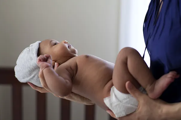 Powerful Photo of a Mom in a Diaper After Birth