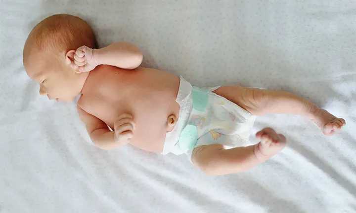 Newborn with outie belly button