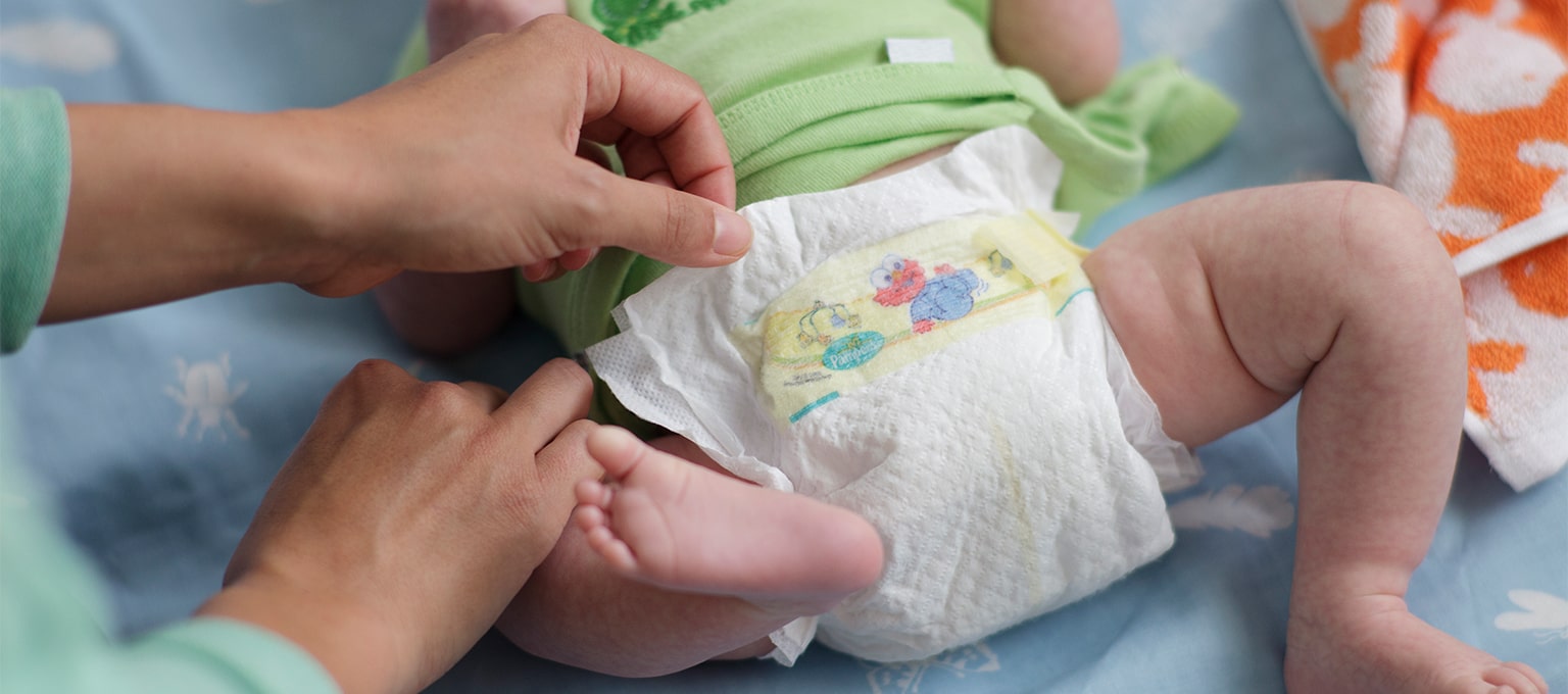baby sensitive to wet diaper