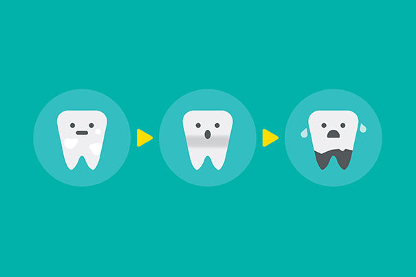 inf_Tips_de_higiene_bucal_para_prevenir_la_carie_del_bebe_1 Previene la caries dental en tu bebé