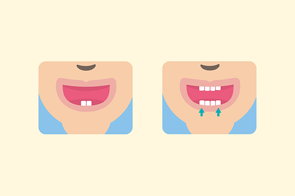 inf_Conozca_las_diferentes_etapas_de_la_denticion_de_su_bebe_1 Cómo limpiar los dientes de tú bebé