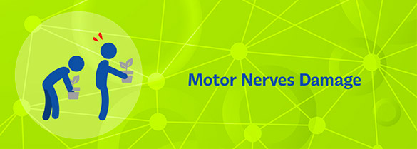 Jenis kerusakan saraf: Motor nerve damage