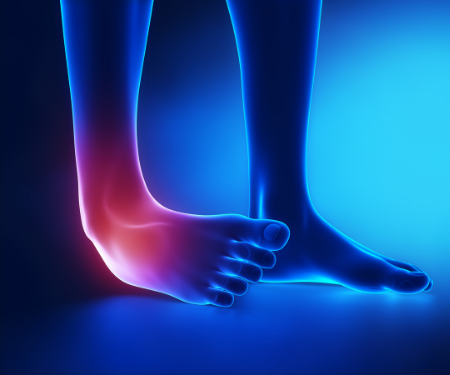 Ankle Sprain Physiotherapy Treatment