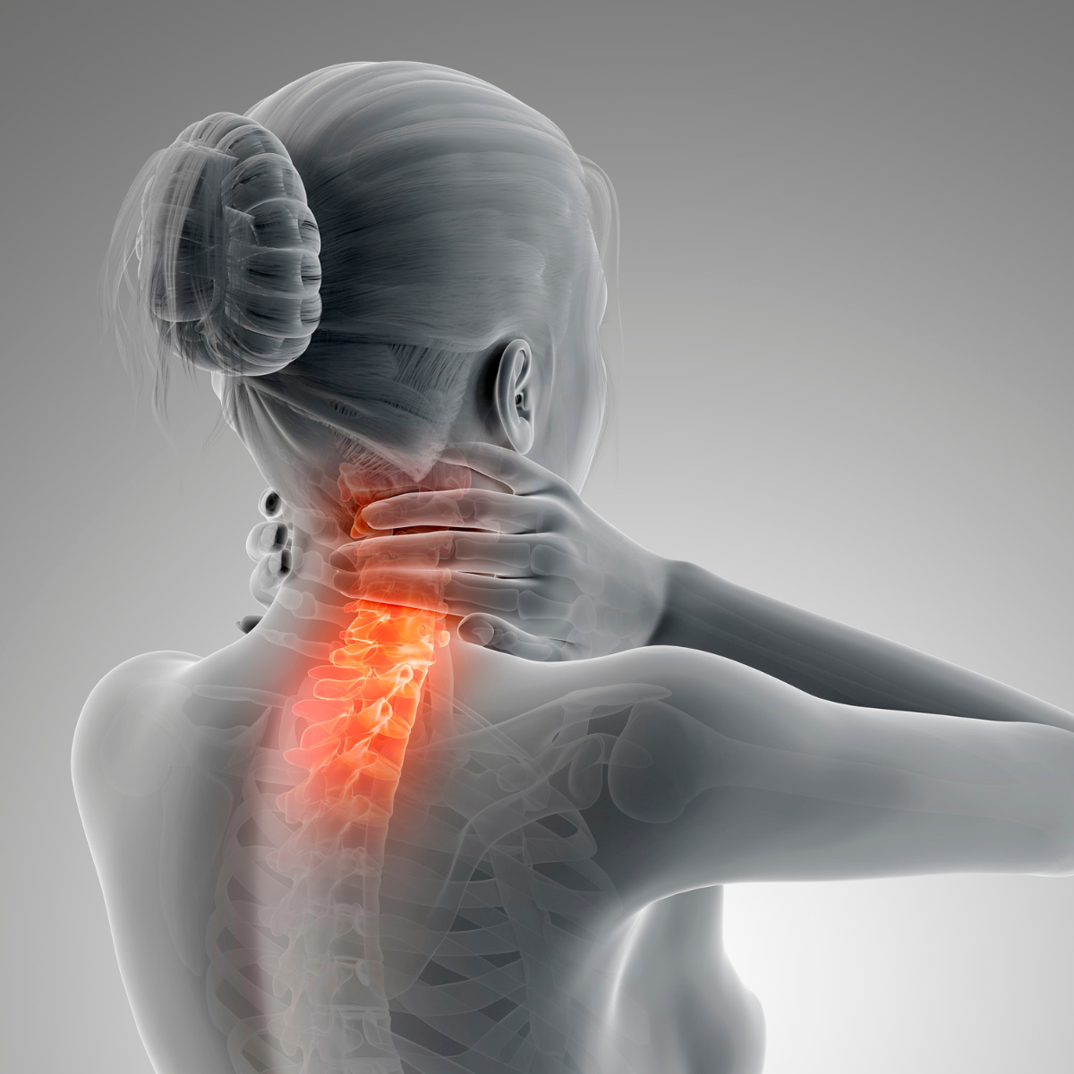 Herniated Disc- Cervical Spine | YourPhysio