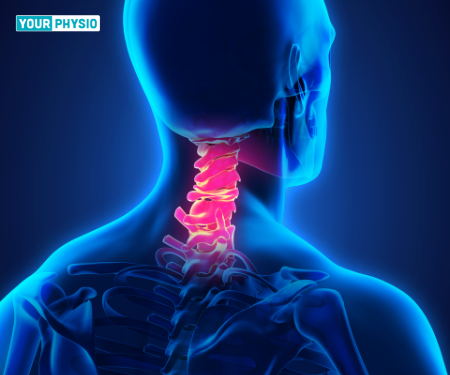 Special Test For Cervical Spondylosis