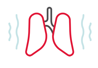 PULMONES SANOS