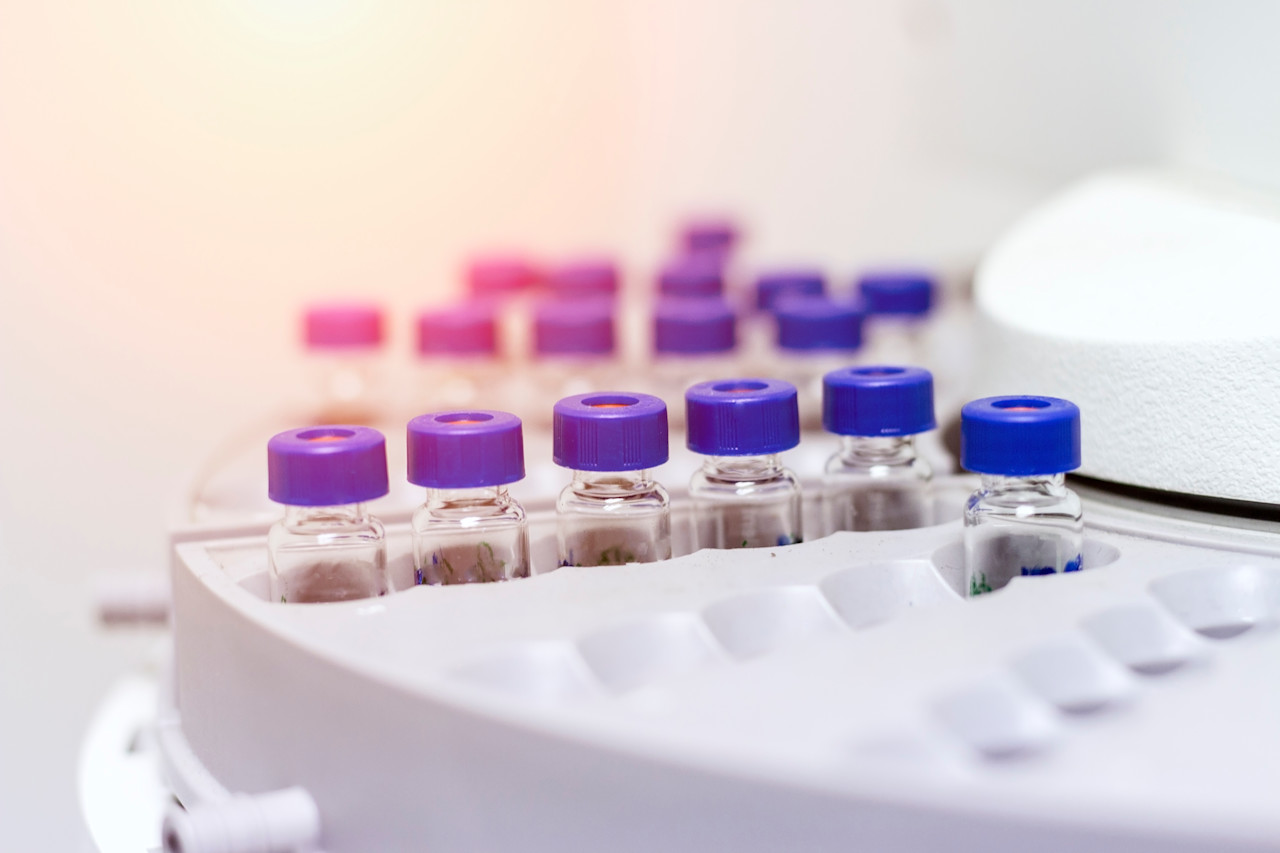 HighResolution Mass Spectrometry HRMS Analysis Measurlabs