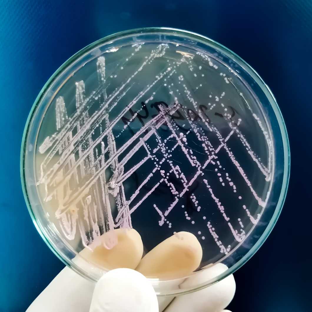Mikrobiologiset analyysit