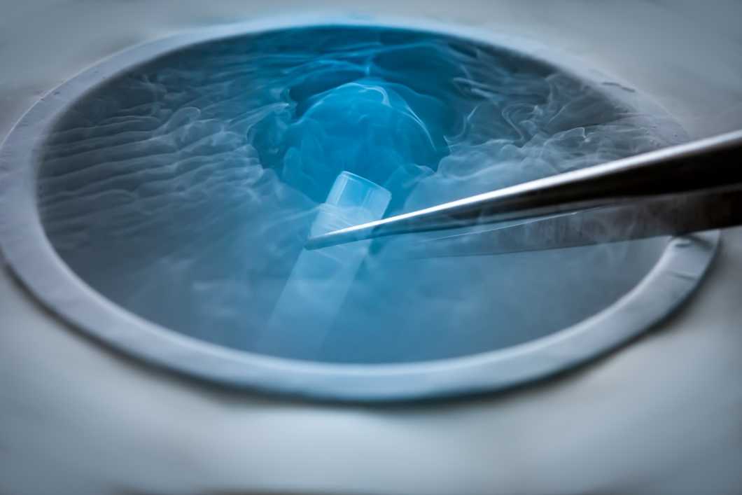 Cryogenic EM