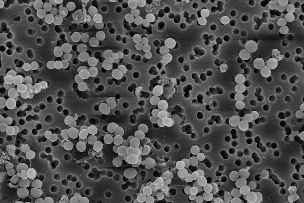 SEM-EDX