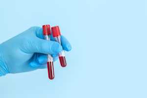 Guide to reliable microplastic analysis of blood and other complex biological samples
