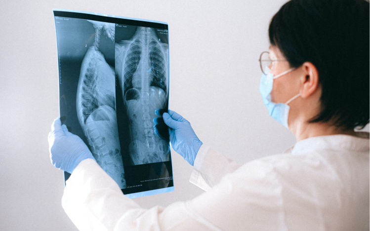 Doctor examining an X-ray.