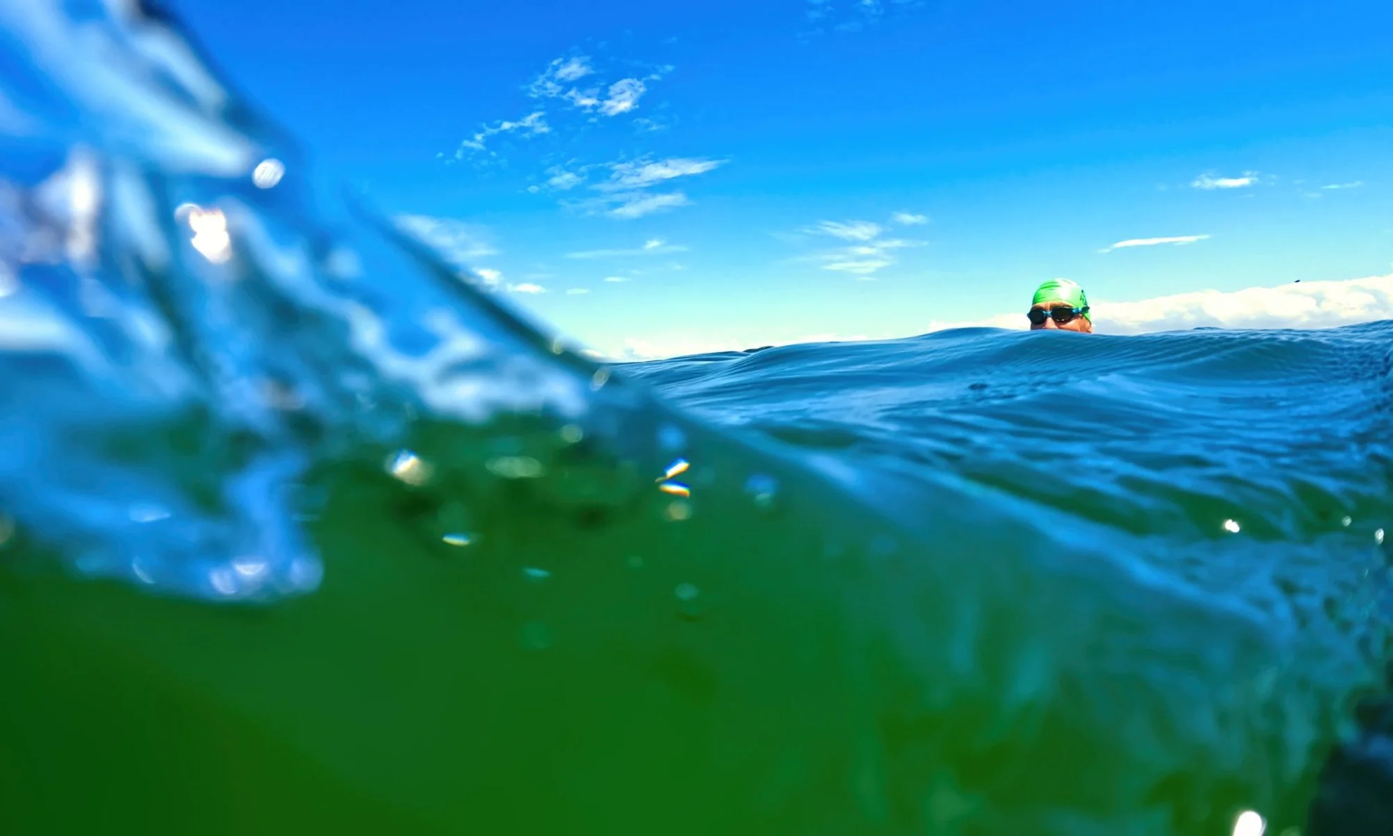 Waterlogging