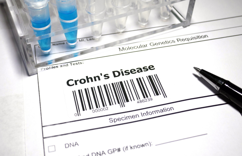 Everything You Need to Know About Crohn's Disease