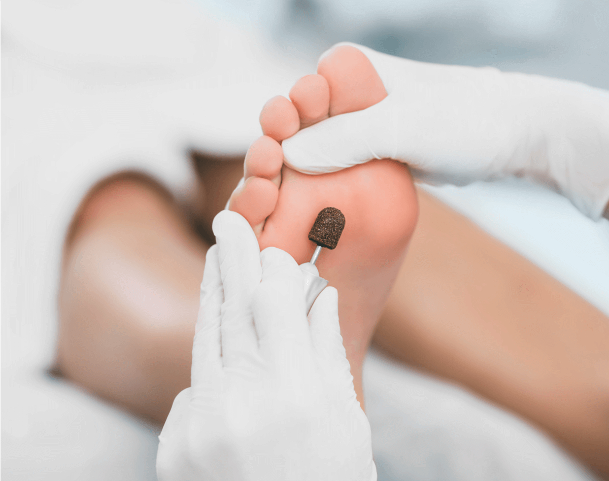 The medical pedicure