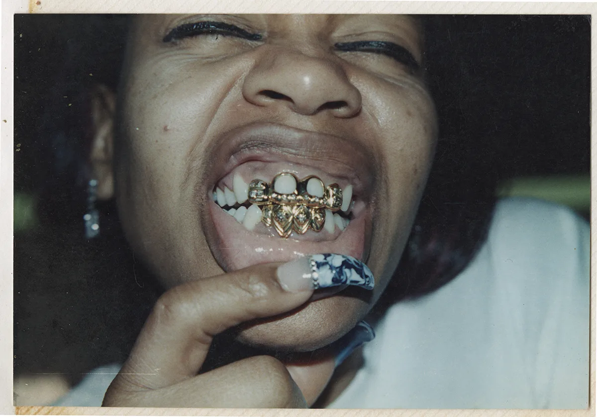 WePresent | The history of Eddie’s Famous Gold Teeth
