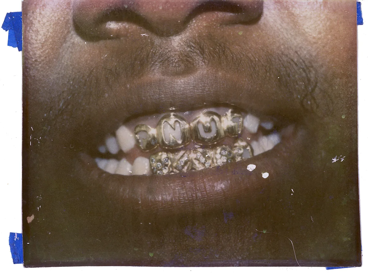 WePresent | The history of Eddie’s Famous Gold Teeth