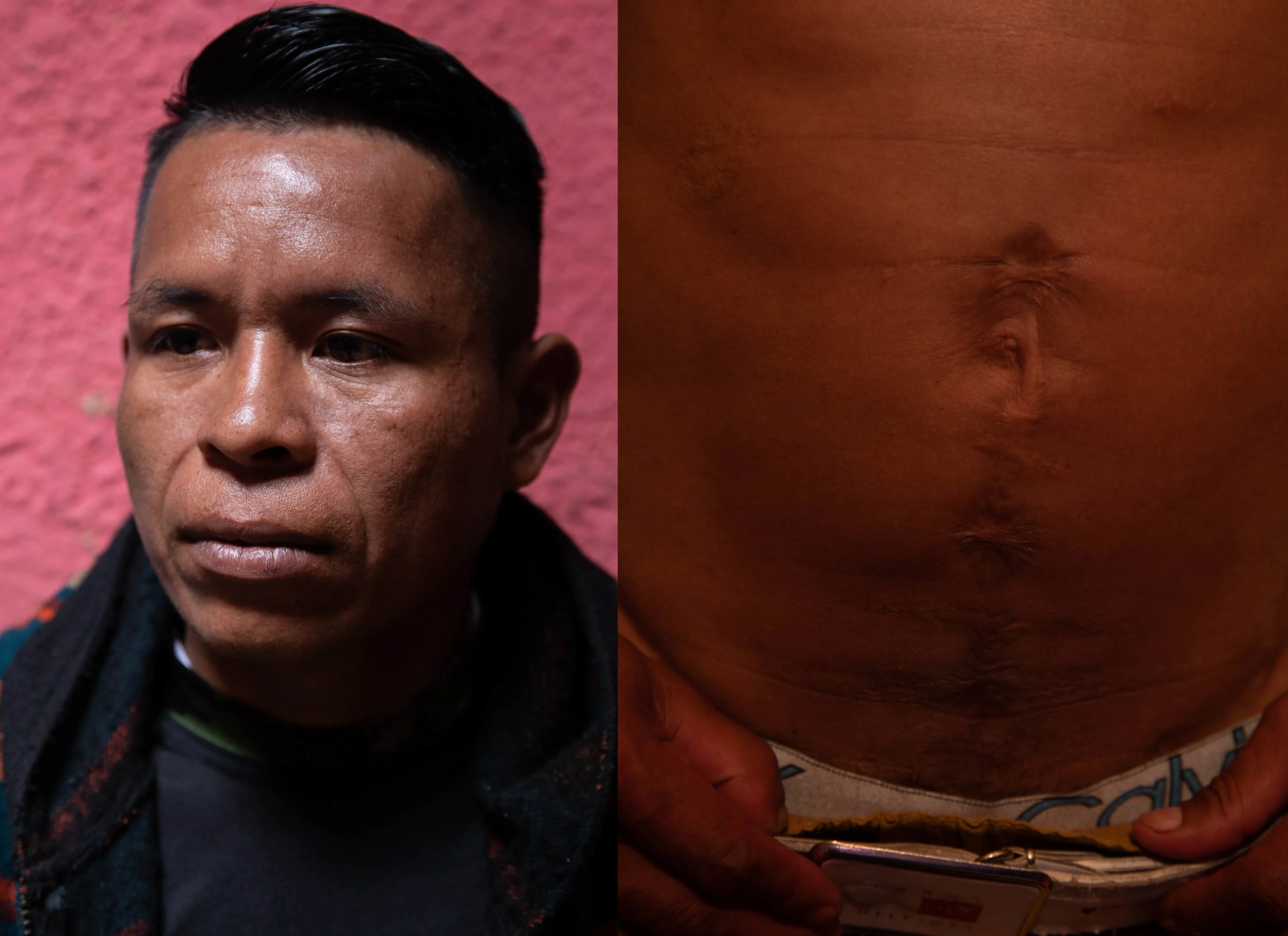 Fernando Marukama, displaced Embera leader from El Choco. In 2006 he was mistakenly shot in the lower abdomen by a military patrol.