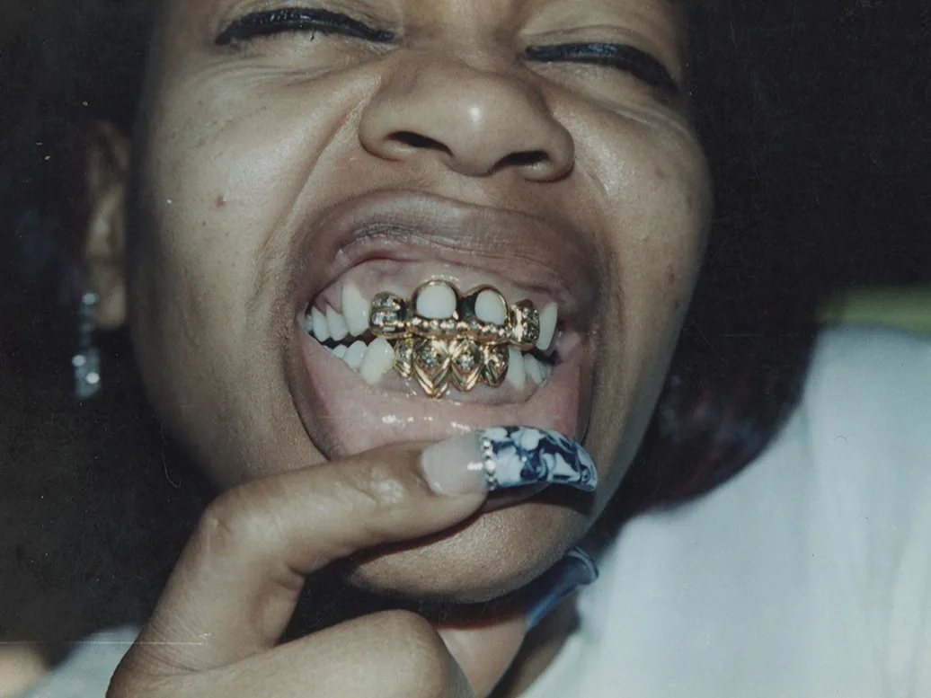 Mouth Full of Golds