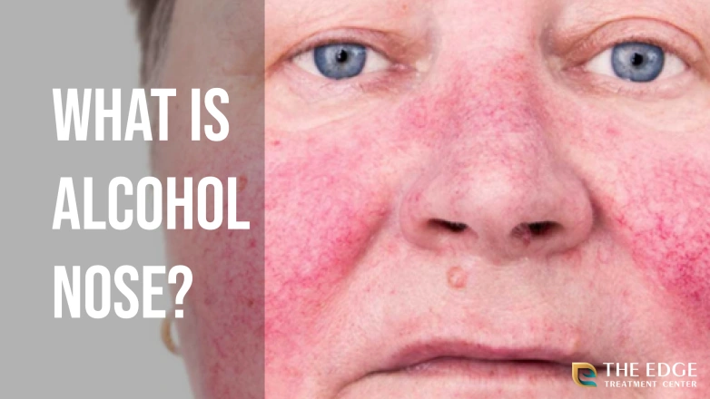What is Alcohol Nose?