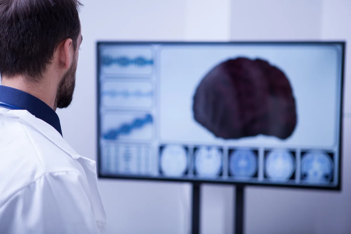 TMS: Doctor looking at a monitor with brain scan imagery