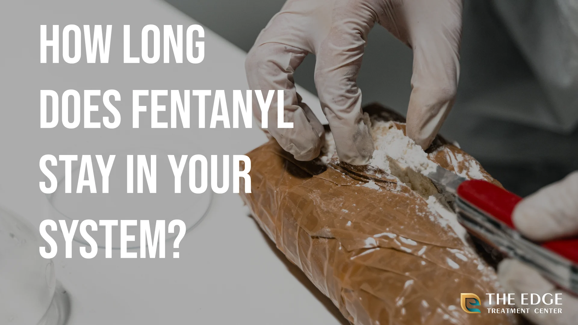 Fentanyl Addiction: How Long Does It Stay In Your System? Fentanyl Addiction: How Long Does It Stay In Your System?